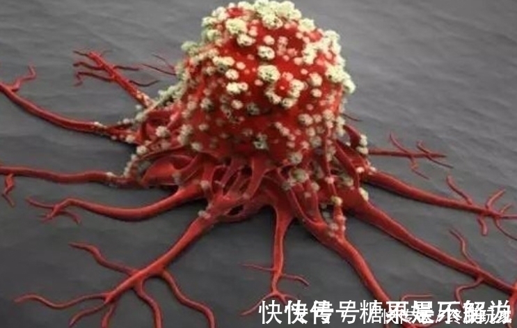 癌症|肿瘤手术后复发的几率是多少？做好4件事，或许有助降低复发率