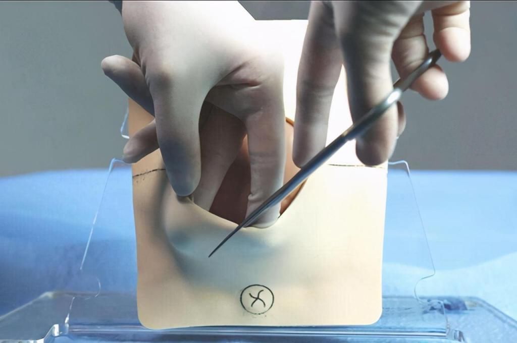 剖腹产|顺产和剖腹产,哪个更受罪过来人一个先苦后甜,一个先甜后苦