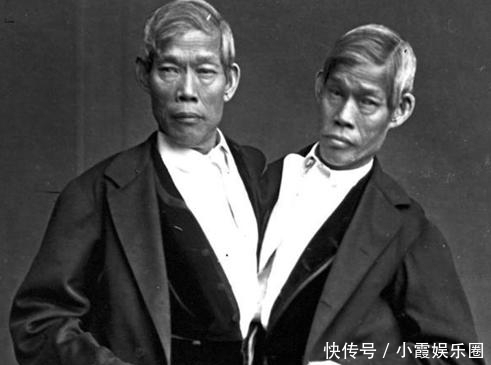 马戏团|泰国连体兄弟,在美国马戏团打拼10年,迎娶两姐妹,生了21个孩子