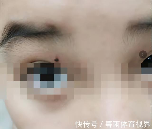 学校|孩子被欺凌、身上20处铅笔尖刺入、差点眼瞎:如何才能保护孩子