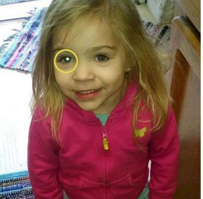 父母|妈妈为可爱女儿拍照, 发现照片不对劲,到医院检查后父母心疼