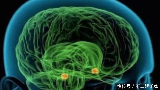 恭喜|最新老年痴呆测试图:能看到五个人的恭喜你!大脑或比同龄人年轻