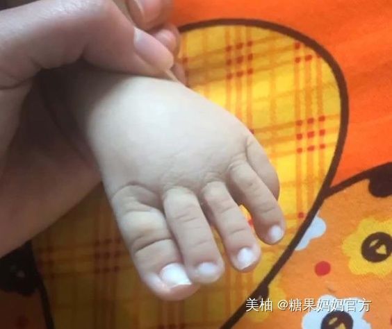 脚趾长|宝宝脚趾赛手指,妈妈伸出脚大家又沸腾了,网友长大得长多高