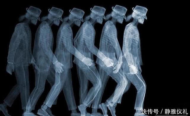 摄影 X光的世界到底长什么样杰克逊太空舞步,接吻让人哭笑不得