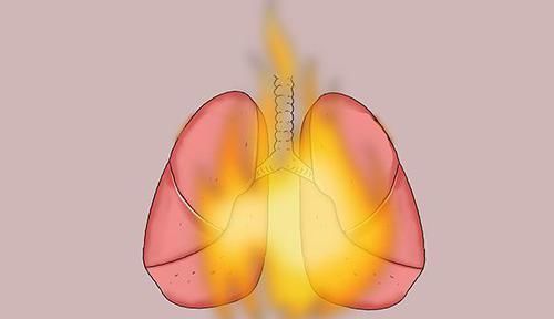 医生|有的癌症患者,不药而愈是咋回事医生坦言有3种可能性