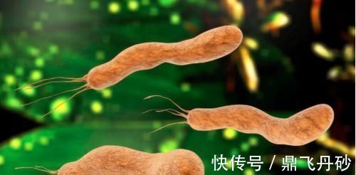 胃病|幽门杆菌“最恨”1种水,隔三差五吃,幽门菌全转阴,胃病自己好