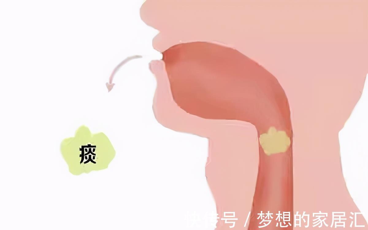 白痰|吐出的痰液颜色不同说明了什么?黑痰、黄痰、白痰,哪个更严重?