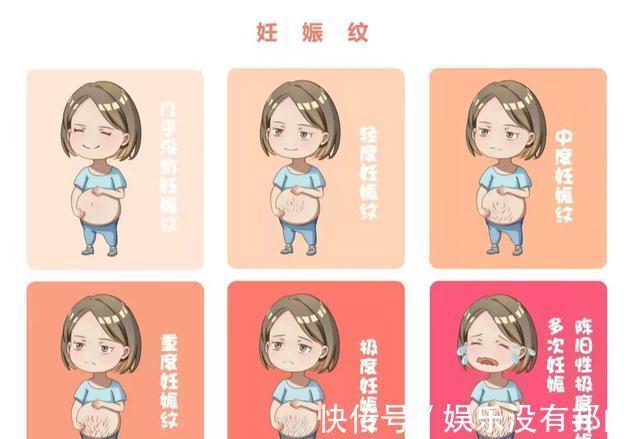 怀孕|生下宝宝后,身上没有妊娠纹,或许因为我做了这几件事