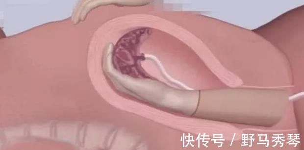 剖腹产|顺产最痛的四个瞬间,过来人坦言第三个强忍,第四个彻底崩溃了