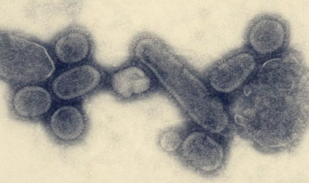 报道|对付瘟疫,人类社会几百年来并无本质变化,结果有何不同?