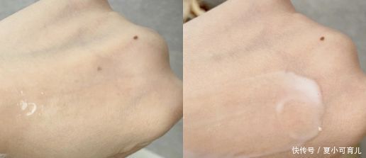 护肤|孕期不护肤,衰老13岁!显老又难看,教你5招,轻松做最美孕妈