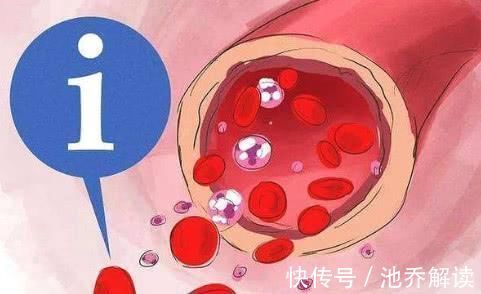 血管|不想血管被堵死, 这些食物要常吃,清理血管垃圾,降压又降脂