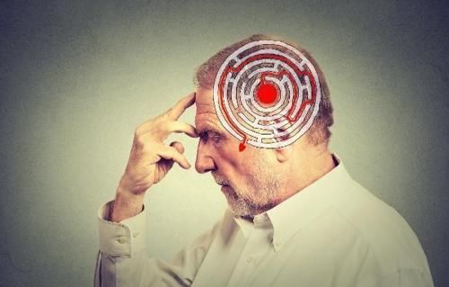 暂时性|50岁以后,清晨若出现4个表现,多半是“脑梗”要发生,了解一下