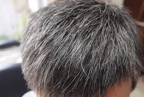 营养|如果女性白头发增多,不要总认为老了,或是因为体内缺乏3种营养