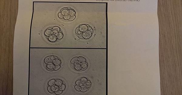 血泪史|悄悄话：求子血泪史，第一次试管疗程，植入、开奖