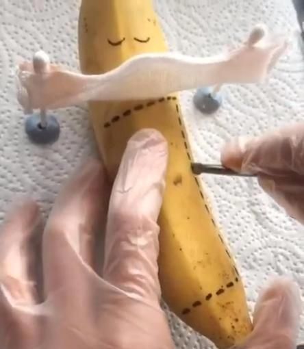 过程|剖腹产真的很轻松吗?看完“香蕉产妇”的分娩过程,或许你会改观