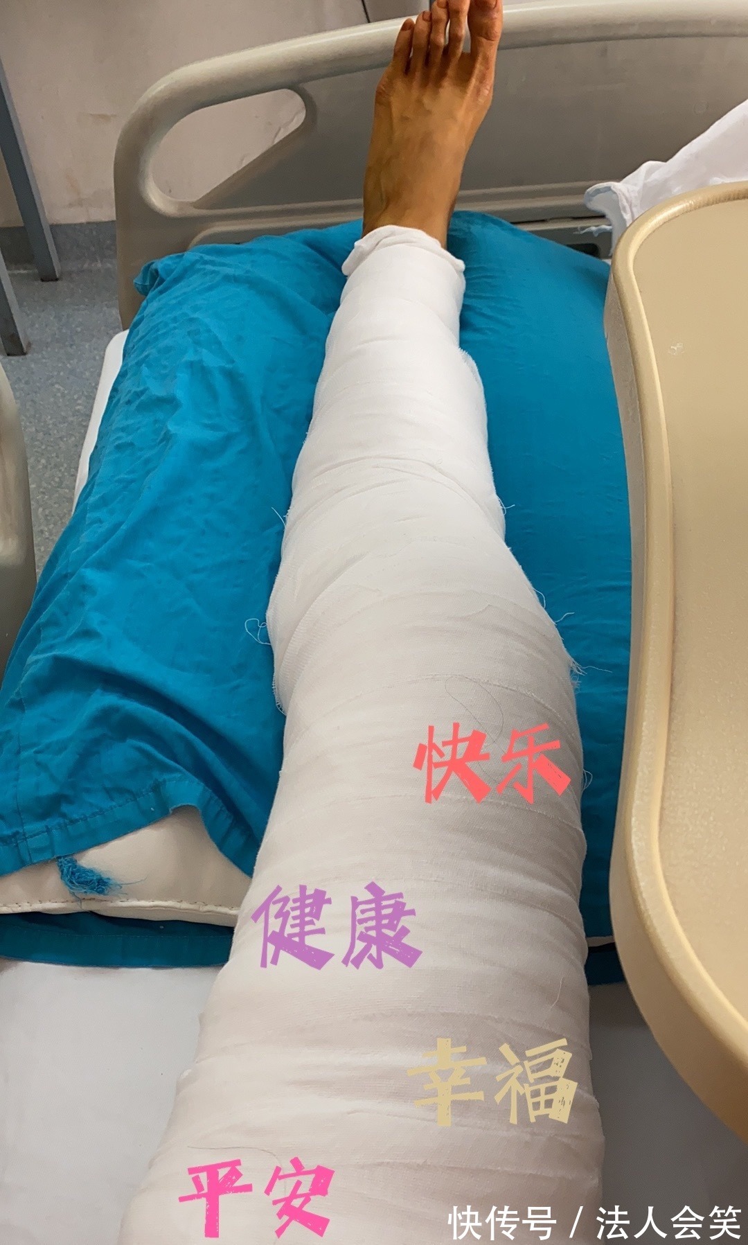 国手|女排国手差距有多大?朱婷治手腕,张常宁治腿,王梦洁割双眼皮?
