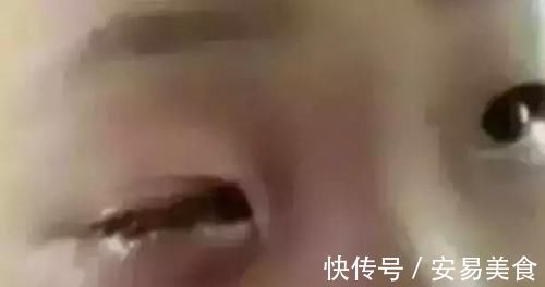 眼珠|仅20分钟男孩眼珠被溶化,这样东西每家都有,父母还需提高警惕