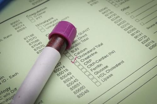 化验单|血脂高医生为何不建议用药？如何读懂化验单？4大问题，值得收藏