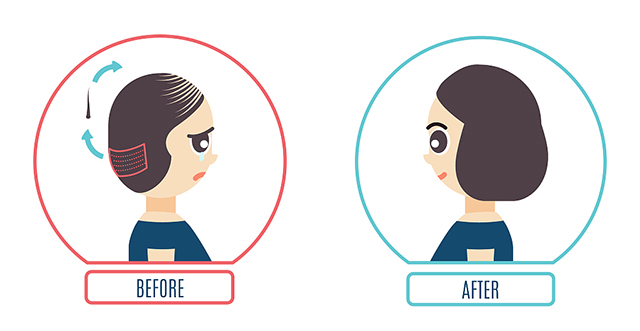 头发稀少怎么办，这个方法适合你！