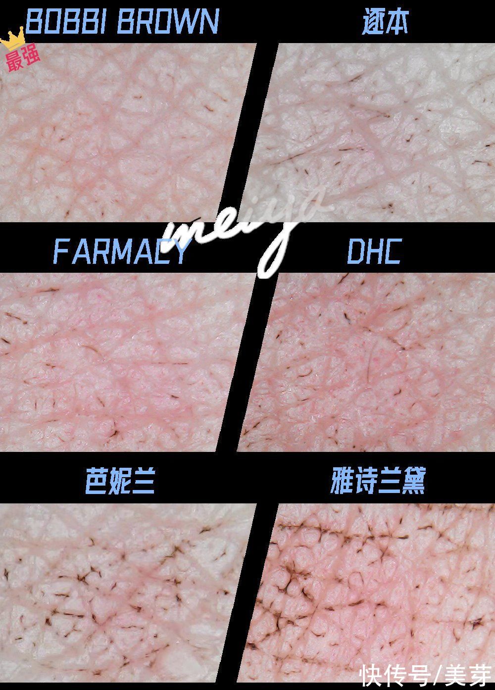 肤感|当皮肤放大1000倍，脏得我震惊了