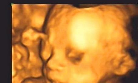 孕期|孕期，若胎宝宝有这3个“表现”，可能是个“高智商”宝宝，恭喜