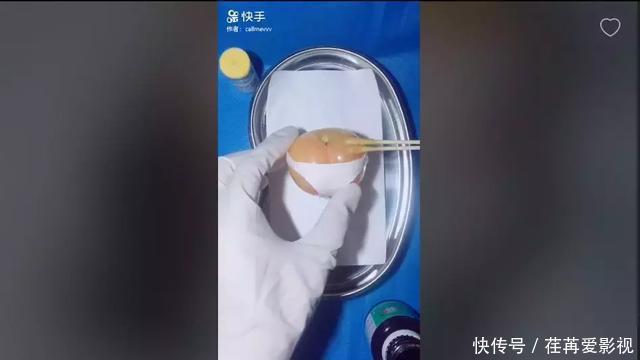 王醫生|32歲醫生竟給水果做手術？一夜吸粉12萬！網友：“我的膝蓋跪爛了”