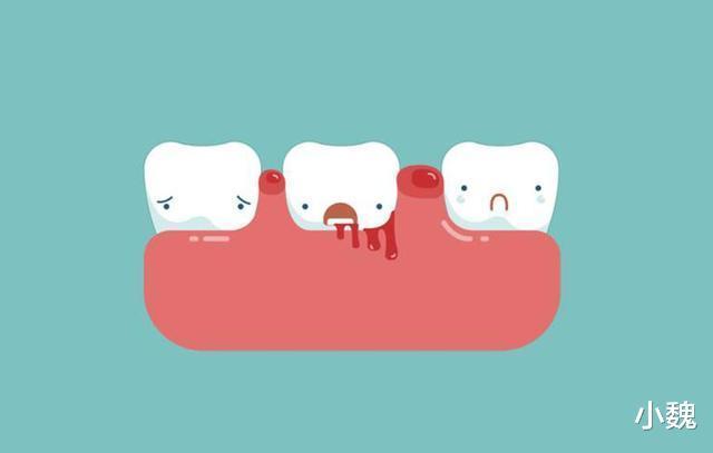 列入|世卫组织3种蔬菜已被列入伤肝“黑名单”,提醒父母,尽量少吃