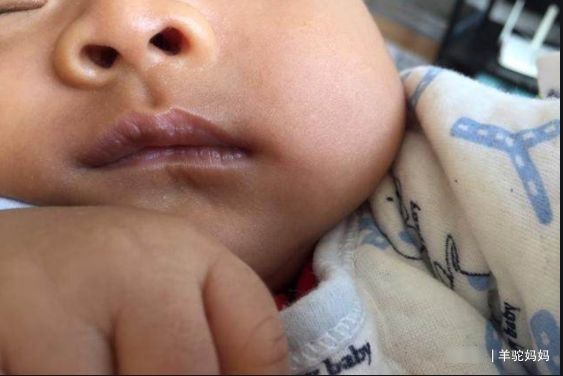 积食|“脾胃虚”的宝宝，身上这2个部位经常出汗，父母早了解娃早受益