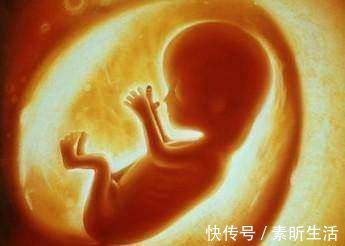 畸形|胎儿畸形高发期,安全度过孕初期,孕妈们就可以安心等待分娩了