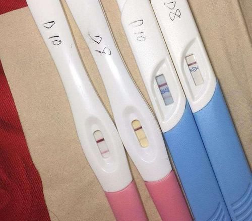 宝妈|胎儿为什么会脐带绕颈多数人以为是受睡姿影响,真相让人意外