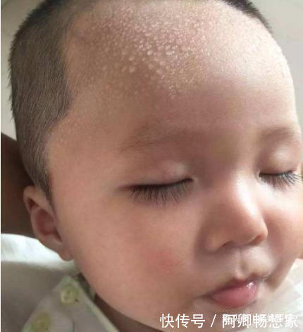 奶粉|孩子睡觉时头上总出汗,是缺钙吗别着急补钙,搞清原因巧护理