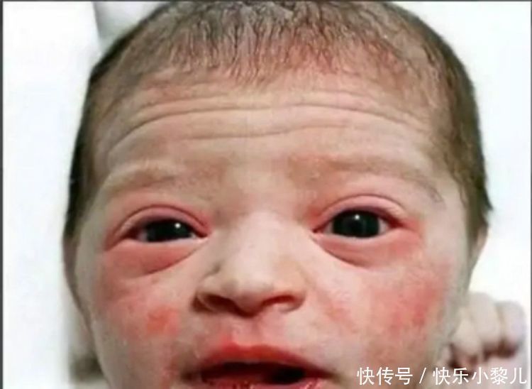 发红|''丑娃''出生遭全家嫌弃，护士却说漂亮，3个月后家人纷纷道谢
