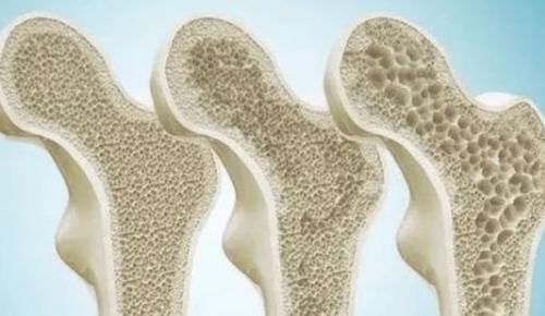 慢性疾病|吃皮蛋，到底对身体有益还是有害？现在告诉你答案，看完抓紧收藏