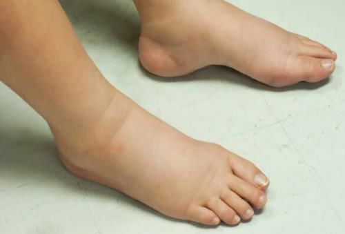 薏米|身体有7个反应,说明体内湿气过重,提醒你该祛湿了