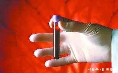 理想|血脂控制不理想 建议:坚持3低原则 搭配3种食物!