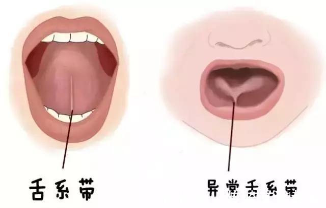 语言|孩子很聪明，就是说话晚、不开口、说不清？因为家长这些错误操作