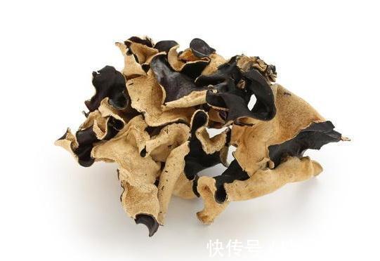 胆固醇|降血脂的妙招找到啦！2物多吃3事少做，血脂慢慢就会降下来啦