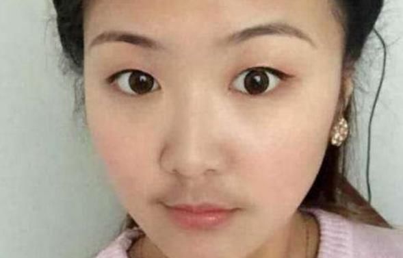 激素水平|为何有些女生的嘴唇上会长出“胡子”？意味着什么？早知早受益