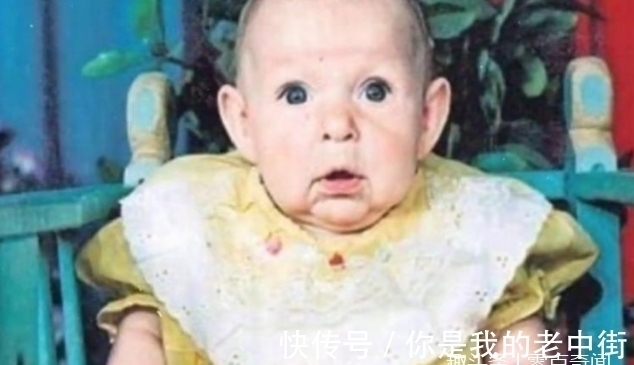 卡蒂亚|刚出生的婴儿满脸皱纹,医生说活不到1岁,21年后奇迹发生了