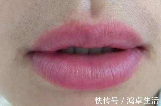 小胡子|女人有妇科病,嘴巴可能知道,3种迹象希望你没有