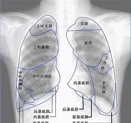 哪些肺部影像报告不必太在意？