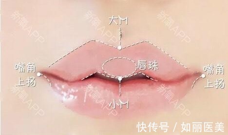 玻尿酸 性感双唇如何拥有?这些常见的唇部整形手术方法你都知道吗?