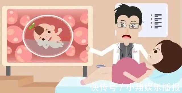 b超|孕妈必知的NT检查, 一篇文章给你讲透咯