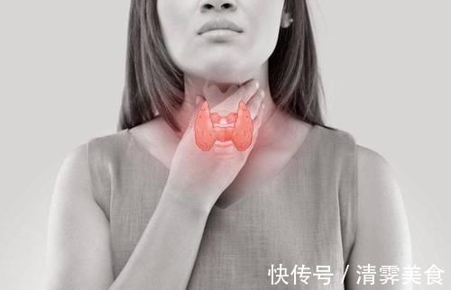甲状腺细胞|这种“肿瘤”偏爱女性,或与4个因素有关,女生都该了解一下