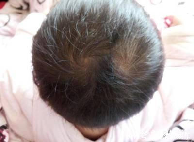 “双顶男孩找不到，双顶女孩没人要”，孩子头上的“旋”代表了啥