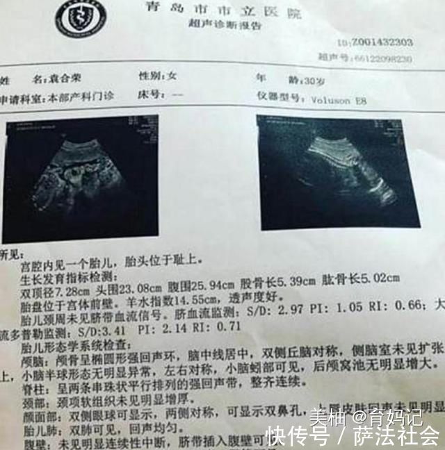 运动强度|“最强孕妈”怀孕6个月,全身肌肉仍旧明显,网友这是孕妈