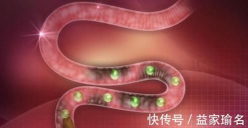 润肠|经常便秘、拉不出?试试多吃6样食物,或能让你甩掉便秘一身轻