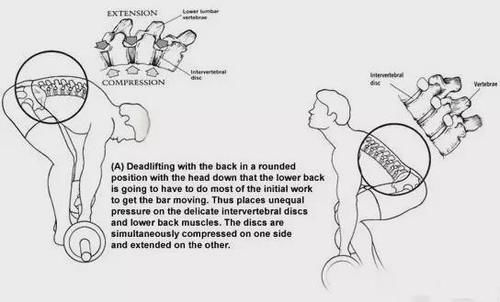 关节|健身动作不规划,小心效果适得其反!