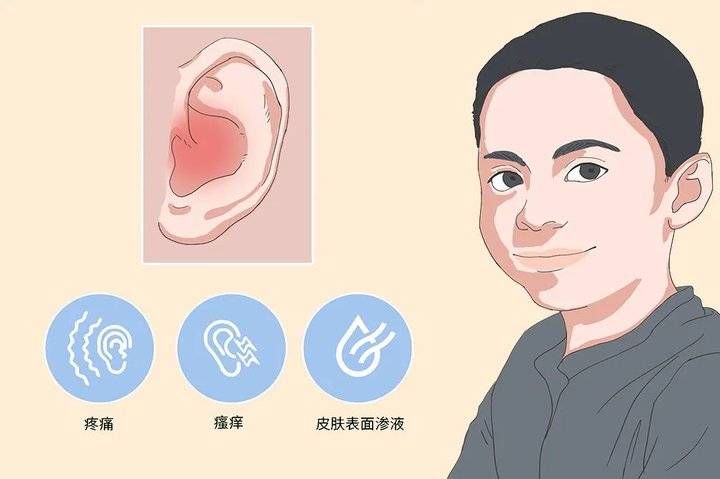 外耳道|游泳时怎样可以预防外耳道炎